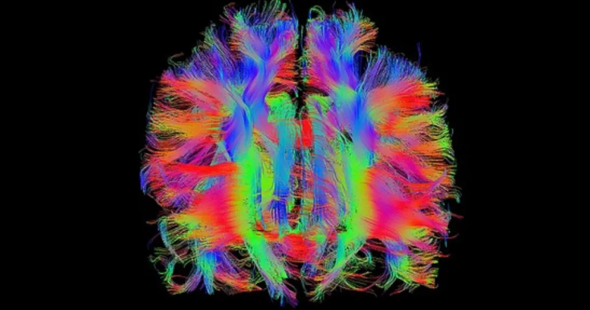 Descoberta nova estrutura no cérebro humano - Atualidade - SAPO Lifestyle